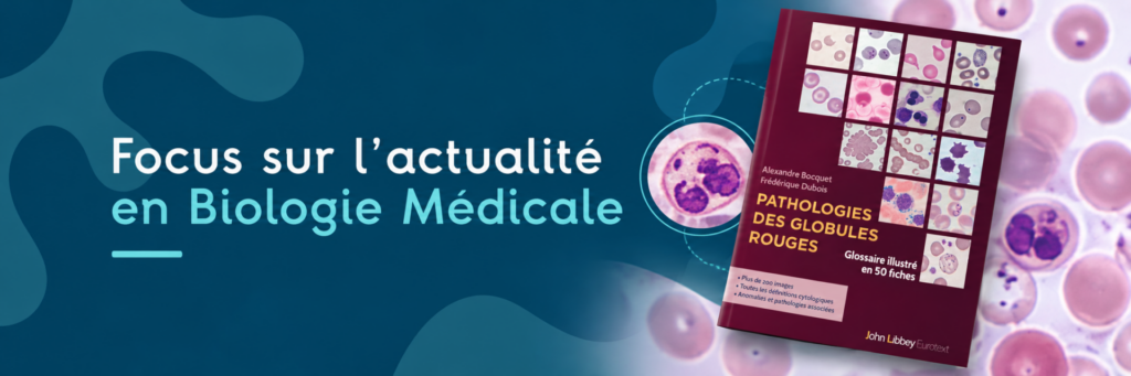 A glisser dans la poche de votre blouse ! Pathologies des globules rouges. Glossaire illustré en 50 fiches.